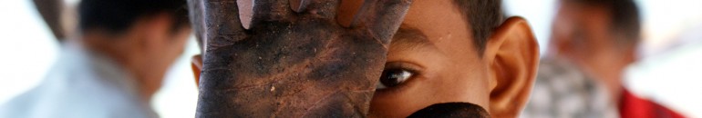 Crianças perdem digitais na quebra de castanha