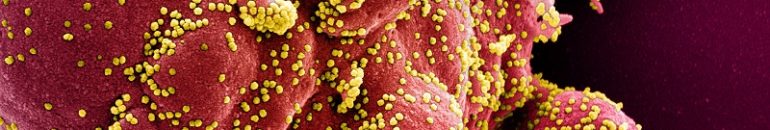 Coronavírus: remédios devem ficar mais caros mesmo após Bolsonaro adiar reajuste